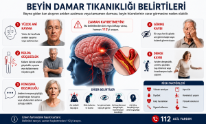 beyin damar tıkanıklığı belirtileri​
