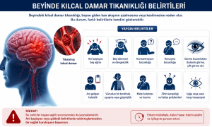 beyinde kılcal damar tıkanıklığı belirtileri​