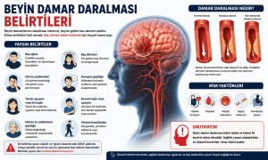 Beyin Damar Daralması Belirtileri