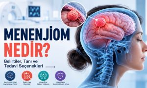 Menenjiom Nedir
