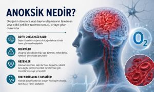 anoksik nedir
