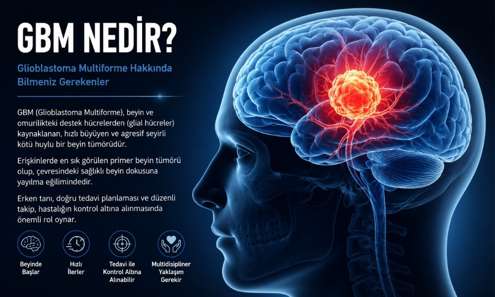 gbm nedir